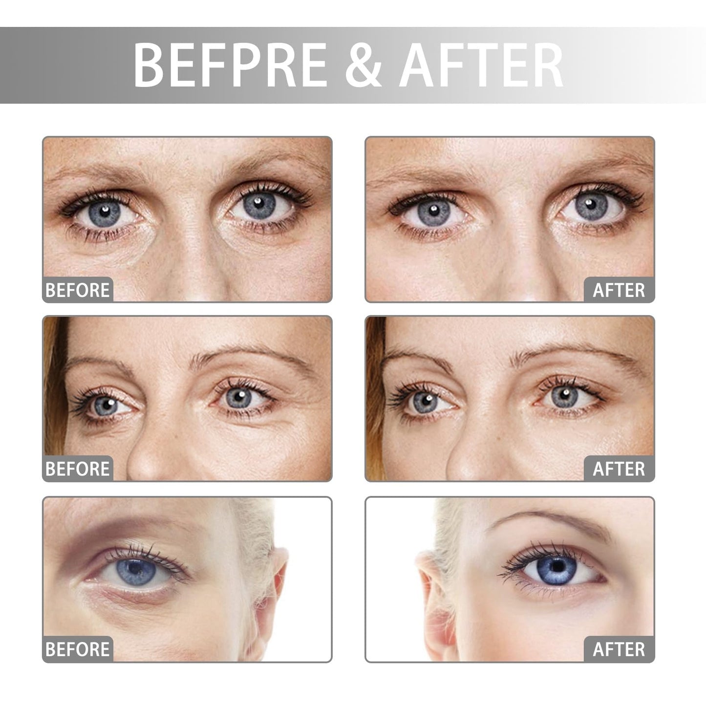 BigyQiu Rollerball Castor Oil,Under Eye Rollerball,Eye Cream for Dark Circles,Castor Oil and Frankincense Eye Roller Ball Oil,Anti Wrinkle Eye Cream,Firming Eye Cream,Eye Cream for Dark Circles