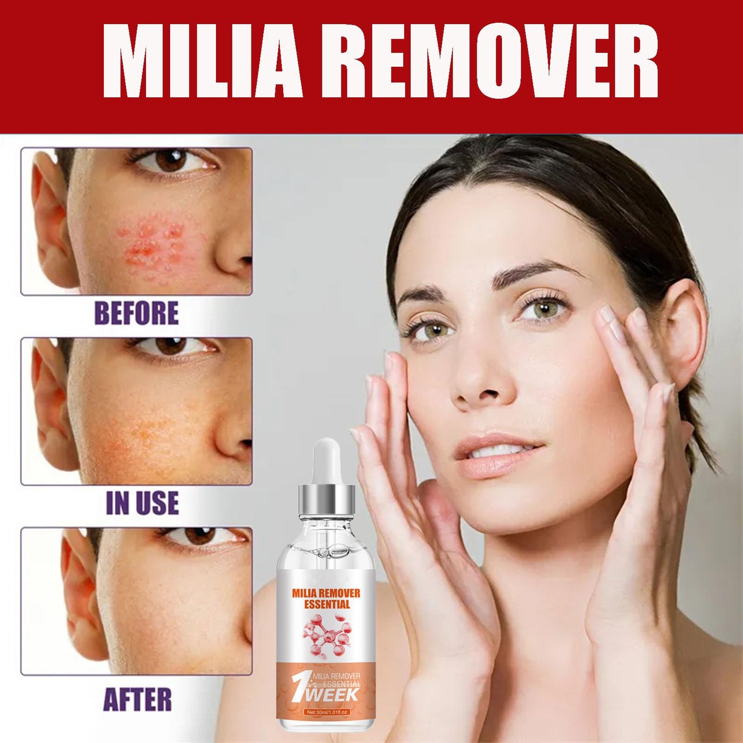 MrCuvaryas Milia Remover, Milia Spot Serum for Face, Milia Spot Removal Helps to Ruduce Milia, Dark Circles Under Eye for Women & Men, Anti Aging Anti Wrinkle, Reduces Bags, Saggy Skin & Puffy Eyes (1PCS)