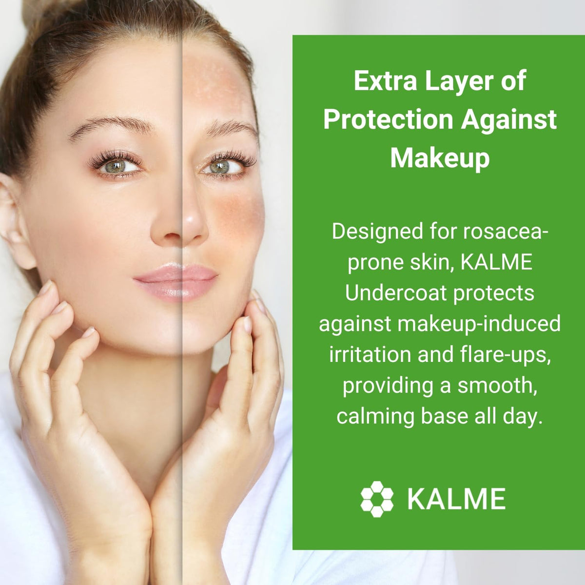 Skin Shop KALME Undercoat – Anti-Redness Primer & Barrier for Sensitive Skin – Lightweight, Fast-Absorbing Protection Against Irritation, Makeup & Flare-Ups (75ml)