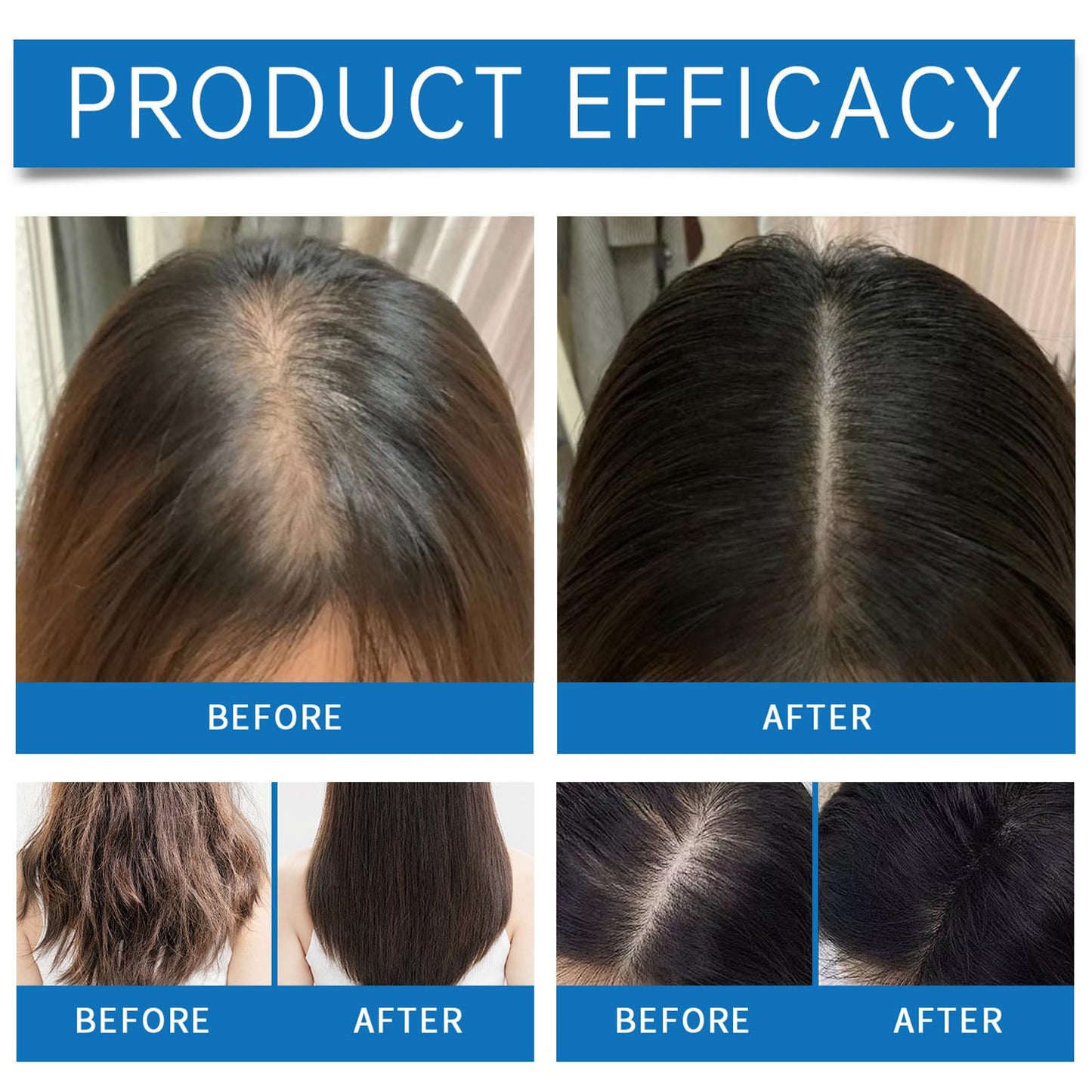 AuraAnge 2PCS Scalp Cooling Hair Ampoule, Scalp Serum & Hair Growth Serum for Men & Women – Top-of-Head Protector with Roller, Non-Greasy, Improves Shine & Cleans Surface, 20g