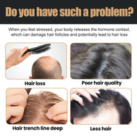 2pcs Root Activator Shampoo,Mane Root Activator Shampoo for Man,Unisex Hair Loss Shampoo,Hair Thickening Shampoo that Repairs,Smooths & Strengthens Hair,Hair Restoration Hair Care Solution