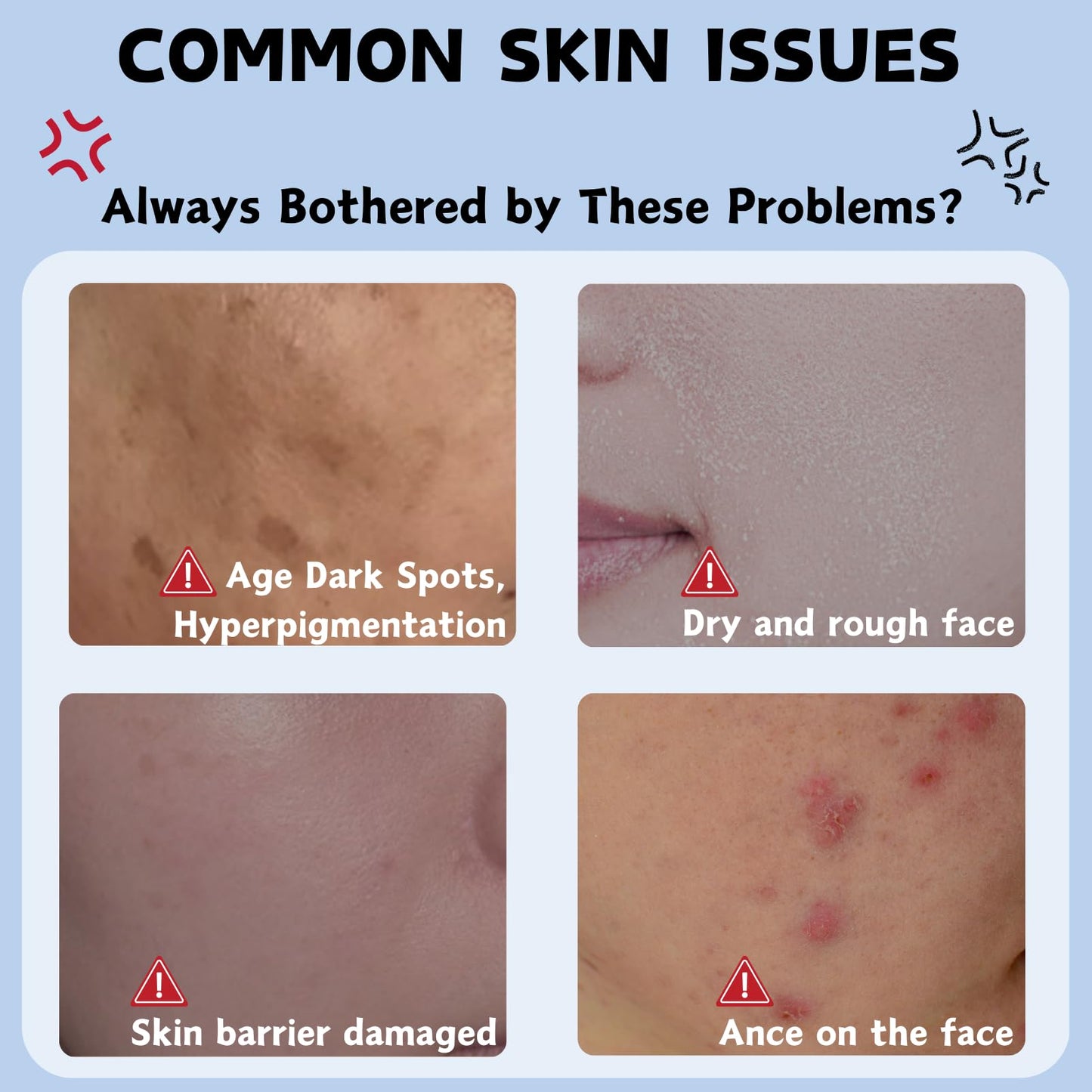 Dark Spot Cream, Tranexamic Acid & Niacinamide Face Cream for Women, Anti Aging Face Cream for Freckles & Hyperpigmentation, Dark Spot Remover for Even Skin Tone, Moisturiser Face Women & Men, 50ml
