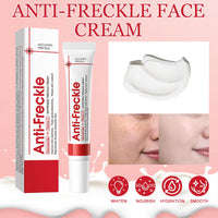 Muiefe 2Pcs Freckle Removal Cream, Dark Spot Remover for Face and Body, Dark Spot Corrector Cream with Vitamin C, E & Niacinamide, Fade Spots Blemishes, Reduces Hyperpigmentation, Improves Skin Tone