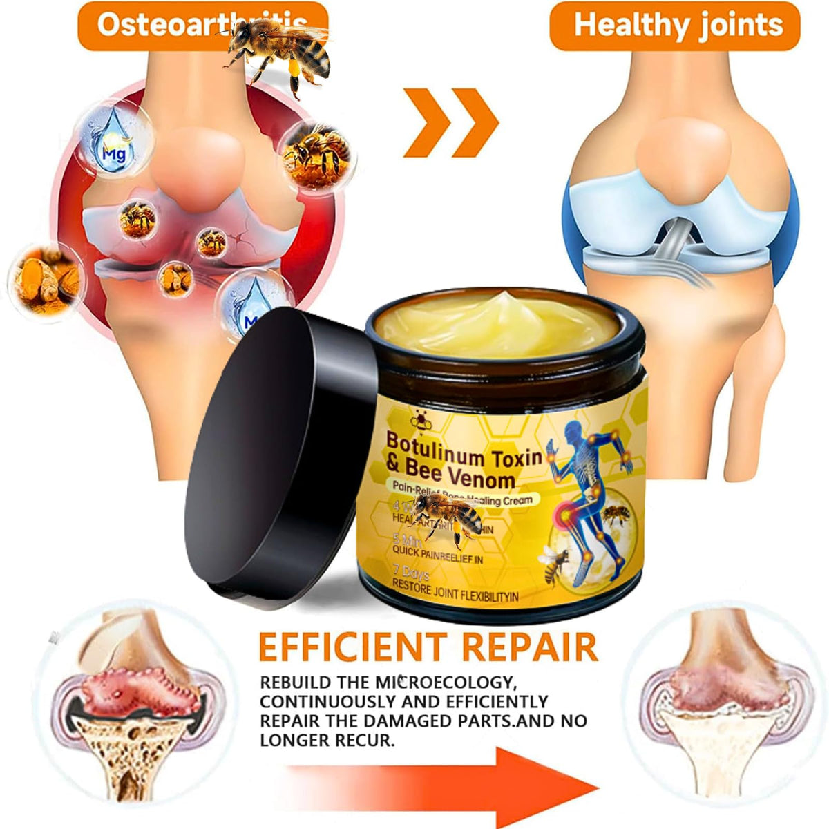 IZBEAUVO 2PCS Botulinum Toxin & Bee Venom Pain-Relief Bone HealingCream, Bee Venom Cream For Arth - Ritis, Natural Joint Relief Cream For Muscle & Joint Recovery, Bee Venom For Neck,Waist,Back Hand Feet & Leg