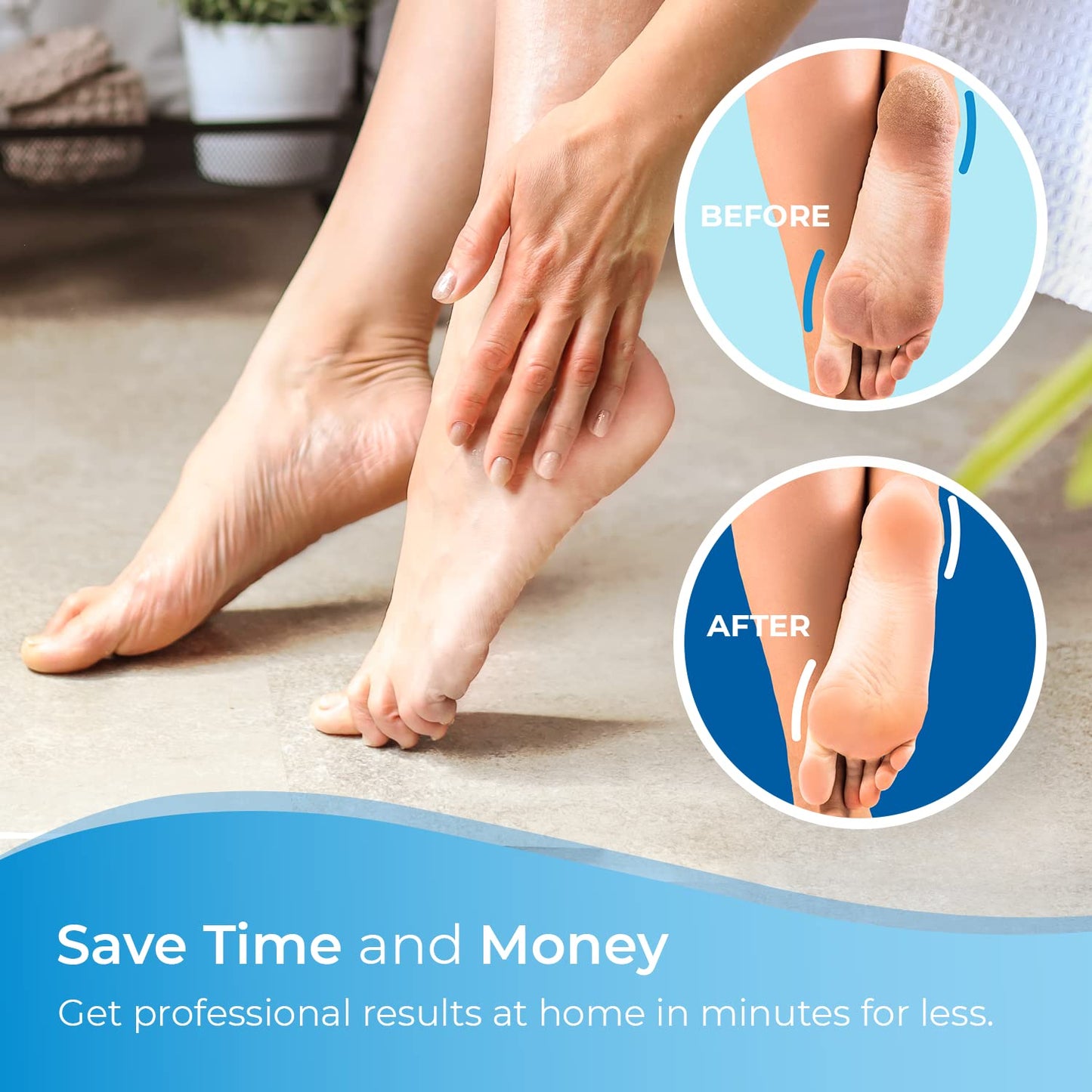My Rollers 4 x Extra Coarse Blue Replacement Rollers Compatible with Emjoi Micro Pedi - Electric Foot File Roller Heads for Rough, Dry and Callused Feet