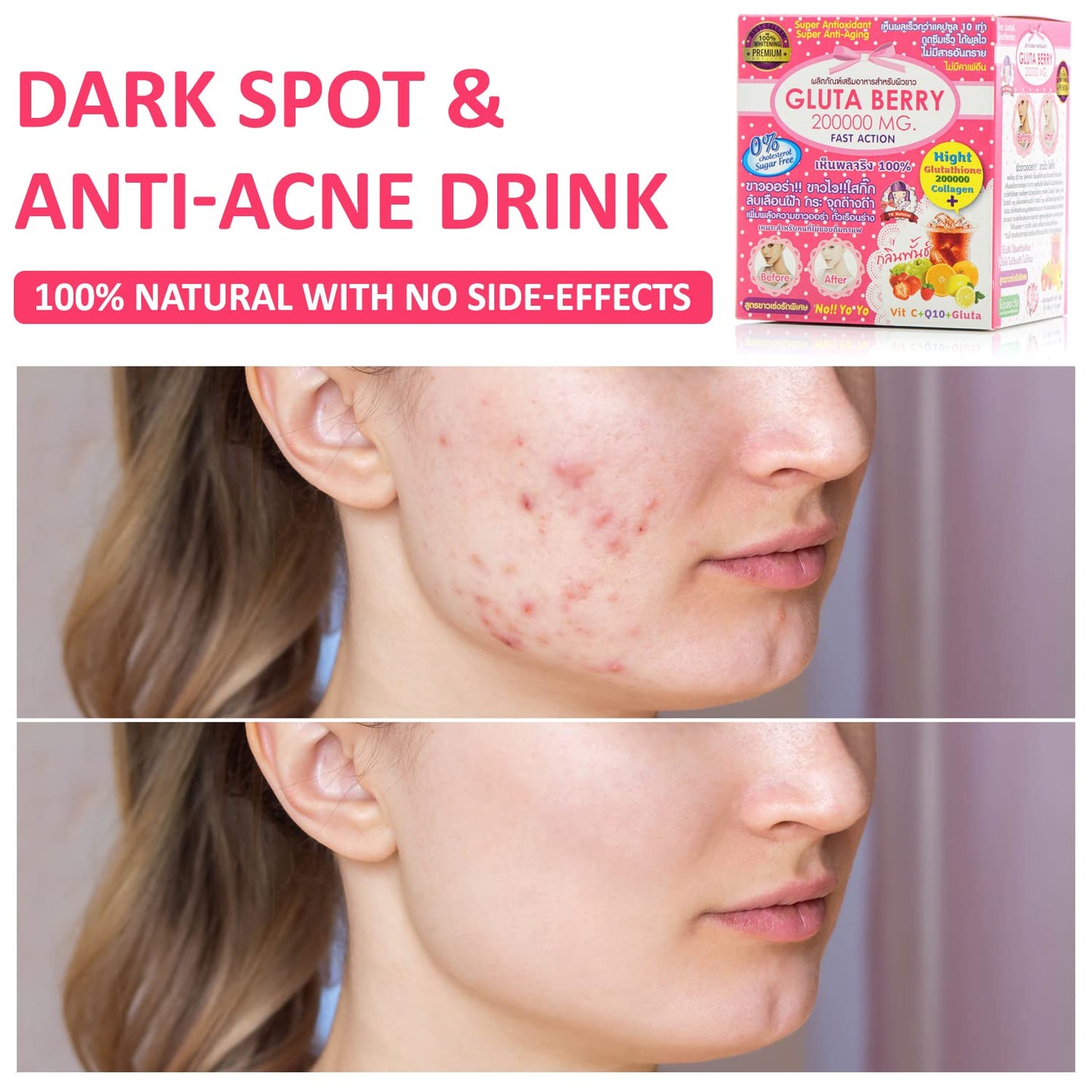Alizée Spa Gluta Berry 200000Mg Glutathione & Collagen Drink Anti Aging 10 Sachets Fast Actions Marine Collagen Skin Nourishment Skin Dark Spot & Anti-Acne (Pack of 1)
