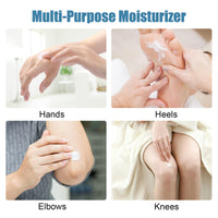 Shengqialun Urea Foot Cream, Foot Cream for Cracked Heels and Dry Skin, Urea Cream Cracked Heel Repair Cream for Feet and Hand, Deep Moisturizing Callus Remover for Hand Foot Body Care (50g)