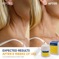 Neck Cream for Firming Tightening & Wrinkle: Korean Made Crepey & Sagging Skin Toning, Anti-Aging Cream for Décolleté, Chest - Acetyl Hexapeptide-8, Collagen Water, Peptides, Skin Derma Rejuven