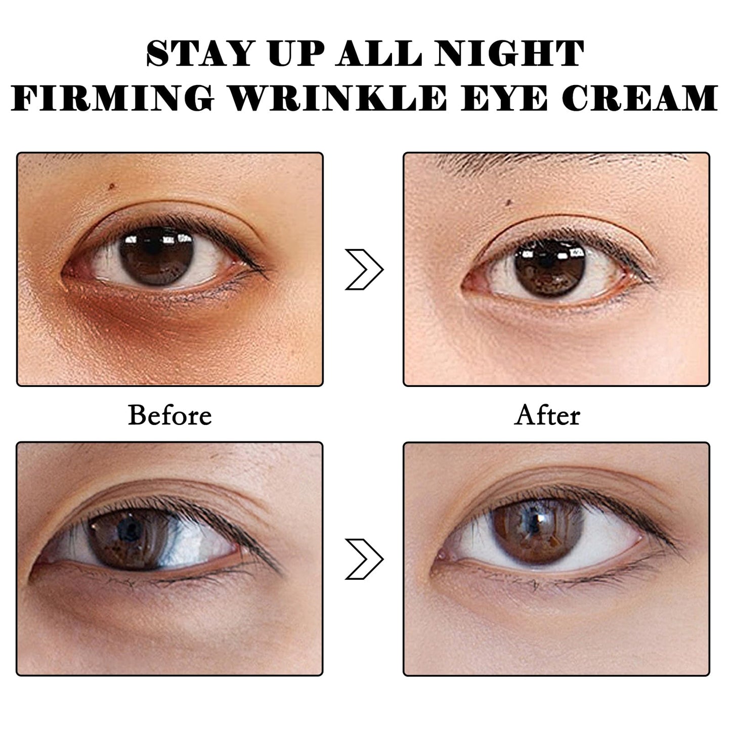 LINXINS Celyn Eye Cream, Celyn Instant Eye Tightener, Celyn Instant Firmx Eye Tightener, Eye Tightening Cream Instant, Fade Fine Lines,Tightens and Smoothes Fine Lines (2PCS)