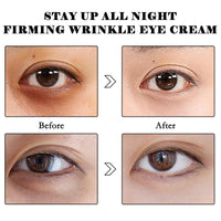 LINXINS Celyn Eye Cream, Celyn Instant Eye Tightener, Celyn Instant Firmx Eye Tightener, Eye Tightening Cream Instant, Fade Fine Lines,Tightens and Smoothes Fine Lines (2PCS)