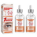 MrCuvaryas 2 PCS Milia Remover, Milia Spot Serum for Face, Milia Spot Removal Helps to Ruduce Milia, Dark Circles Under Eye for Women & Men, Anti Aging Anti Wrinkle, Reduces Bags, Saggy Skin & Puffy Eyes (2 PCS)
