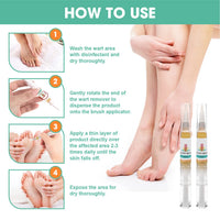 KATIX Wart Remover Fast-Acting and Effect - 2 Pen per Box Suitable for All Skin Types - 2-in-1 Wart & Verruca Treatment, Foot & Hand Wart Strong Remover - Natural & Safe Remover