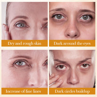 RUICHING Lumibalm Upcircle Eye Cream, Turmeric Eye Cream for Dark Circles and Puffy Eyes, Anti Aging Tightening Reduce Fine Line Under Eye Brightener, Smooth Firm Eye Moisturiser, All Skin Types