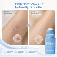 IZBEAUVO 2pcs Razor Bump Smoothing Solution Ingrown Hair Reduction with BHA AHA - High Roller Ingrown Tonic for Underarms Abdomen - Ingrown Hair Serum for Men & Women - Roller Ball Applicator for Tend Skin