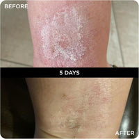 WONDERBALM Multi Use Balm All Purpose Skin Moisturising Cream for Face Body Hair Lips & Cuticles Hydrating Fast Absorbing Vegan Natural Skincare Korean Beauty Multi Award Winning British Brand (50ml)