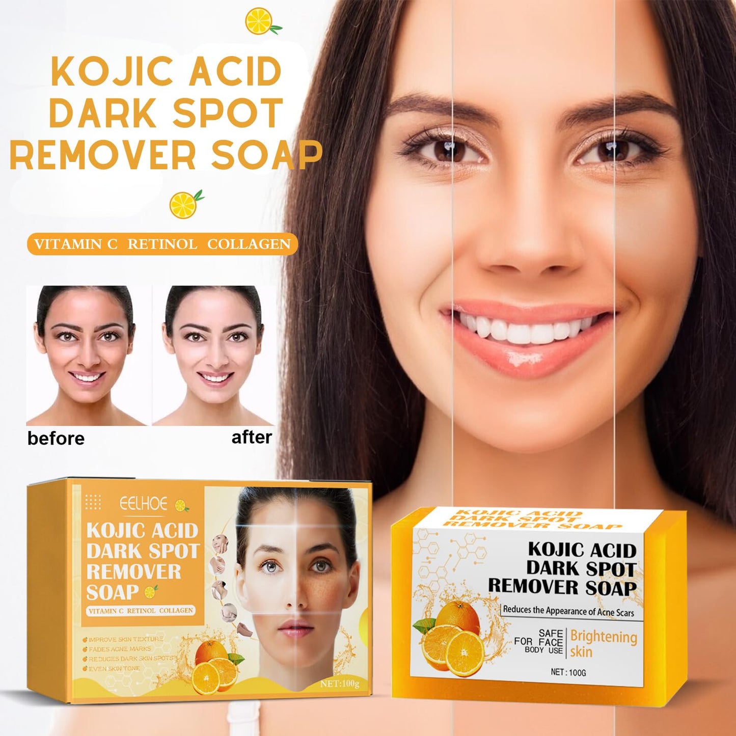 Kojic Acid Soap, Kojic Soap Bar Skin Lightening Soap Bath Soap, Fades Age Spots, Freckles, Revitalize and Moisturizing Cleansing Soap for Dark Spots, Uneven Skin Tone