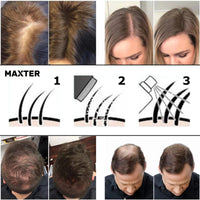 Maxter Bunee Hair Fibres - Hair Thickener - Hair Loss Coverage in 30 Seconds - 100% Natural Cotton Hair Powder Women and Men (Dark Brown 27.5g)