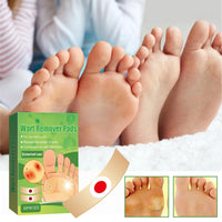 ChunBin 30PCS Verruca Treatment,Wart Treatment Patch,Wart Remover,Plantar Wart Remover for Hands,Pain Free Plasters for Adults,Stops Wart Regrowth,Repair Skin,Easy to Use,Non-Irritating Effective,Pain Relief