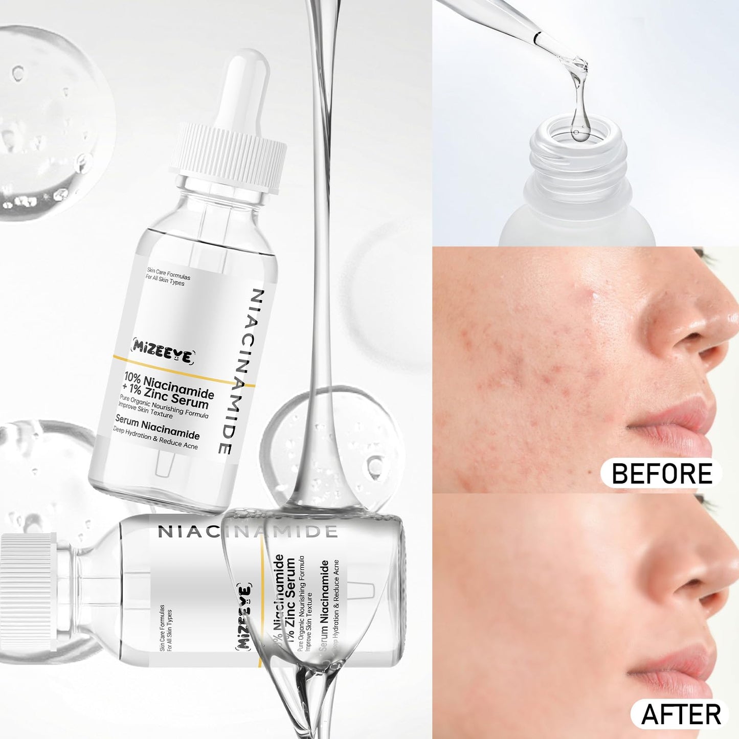 MIZEEYE Niacinamide Serum for Face, 2PCS Moisture Niacinamide Face Serum for Women, Niacinamide 10% + Zinc 1% Serum For Acne, Refreshing.