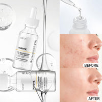 MIZEEYE Niacinamide Serum for Face, 2PCS Moisture Niacinamide Face Serum for Women, Niacinamide 10% + Zinc 1% Serum For Acne, Refreshing.