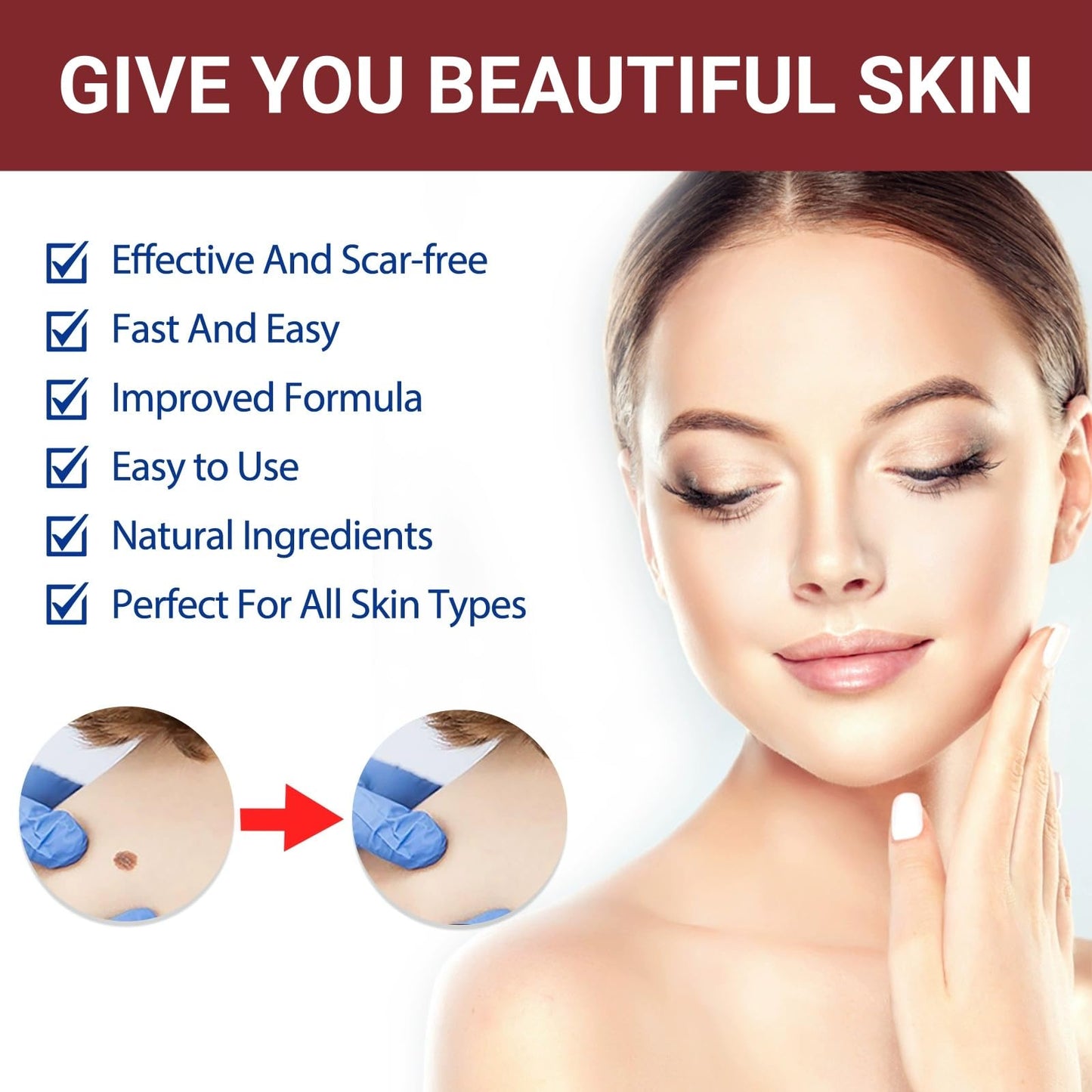 Jinjiar Wart Remover Cream,Effective Wart Removal,Mole Remover,Fast Effective Safe Skin Mole Removal,Wart Treatment for Face & Hands & Body,Wart Remover for Hands,Wart Re-Mover for Face,Flat Wa-rt Remover