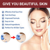 Jinjiar Wart Remover Cream,Effective Wart Removal,Mole Remover,Fast Effective Safe Skin Mole Removal,Wart Treatment for Face & Hands & Body,Wart Remover for Hands,Wart Re-Mover for Face,Flat Wa-rt Remover