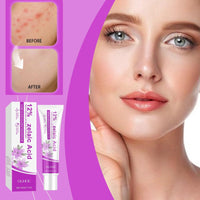 Acid 12% Facial Serum,Anti Acne Cream Face Serum,Aze/laic Aci/d for Anti Acne,A/cid Face Spot Treatment,Night Cr/eam Face Moisturiser,Skin Care Gel, A cne C/ream Skin Care,Acid Serum