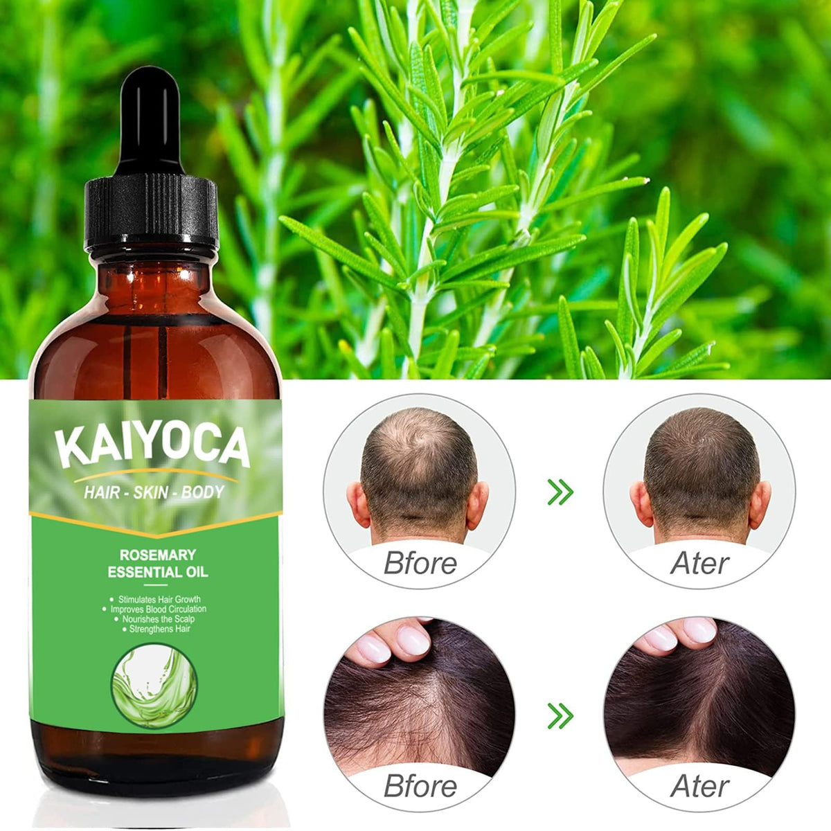 KAIYOCA 2 Packs Pure Natural Rosemary Essential Oils, Hair Growth Scalp Oil for Dry Damaged Hair, Hair Loss Treatment, Nourishes The Scalp, Rid of Itchy & Dry Scalp