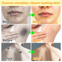 jinyue Bee Cream, Bee Care Cream,Bee Venom Tag Remover，Bee Venom Moles and Warts Removal Cream, Bee Venom Cream Bee Venom Repair Cream for All Parts of The Body 100g