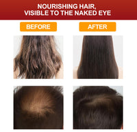 VIDIND Batana Oil Promotes Hair Growth, Natural and Healthy, Can be Used as A Hair Mask and Hair Oil, Moisturizes Hair, Repairs Damaged Hair, Makes Hair Thicker and Fuller (120g)