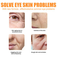 IIDACK DERMANCE Korea Highprime Collagen Soluble Film - Lighten Dark Circles and Bags Under the Eyes, Anti-wrinkle Lifting and Firming Mask (5box)