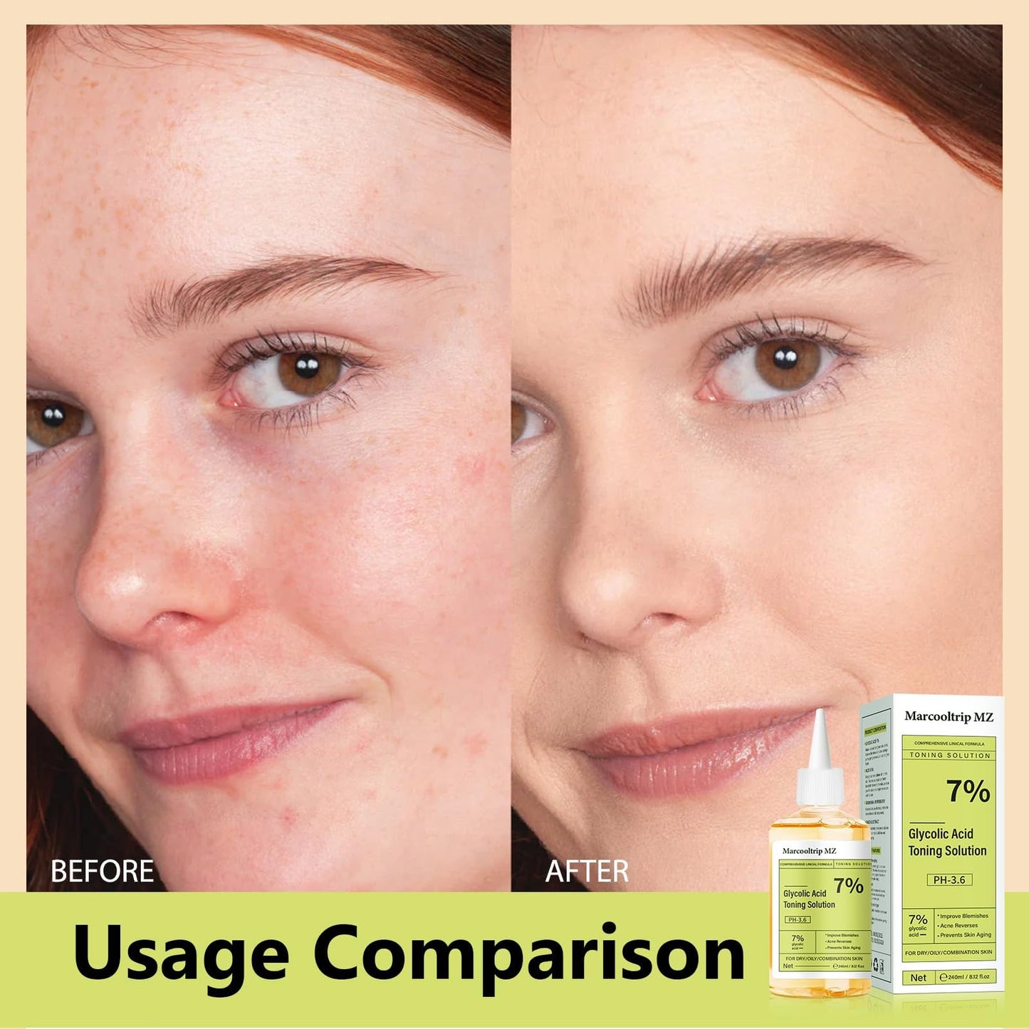 Sengwer Glycolic Acid Toner,Glycolic Acid 7% Toner for Exfoliating, Suitable for Combination and Oily Skin - Hydrating Serum for Face (240ml New)