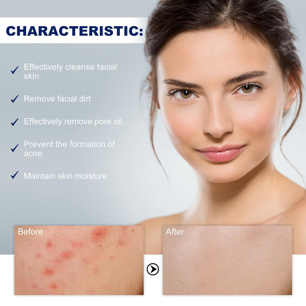Mubuni Acne Foaming Wash,Mild Daily Facial Cleanser for Deep Pore Cleansing,Acne Foa/m Wash,Gentle Daily Cleans/ing Foam,Clea/nsing Fo/am for Women,Facial Wash Women to Soothe Redness,Exfoliating Face Wash