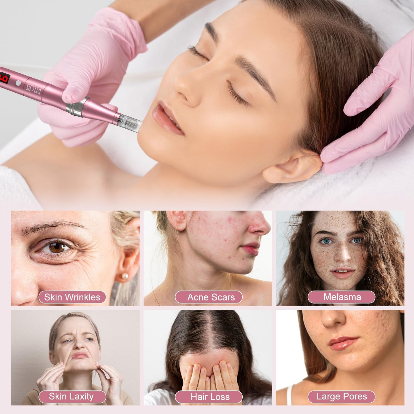 Microneedling Pen 9-Speeds,PELCAS Dermapen 0-2.5mm Adjustable with 12 Pcs Cartridges Type-C Rechargable Electric Derma Pen with LCD Screen for Anti-Aging Skin Care Wrinkle Stretch Marks Hair Loss