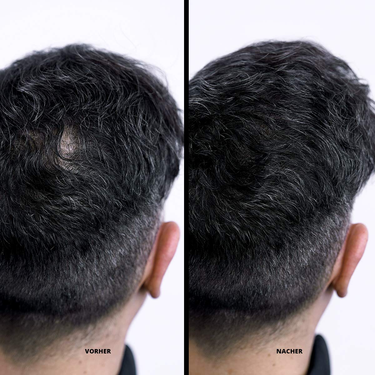 Super Million Hair hair building fibres 25 g