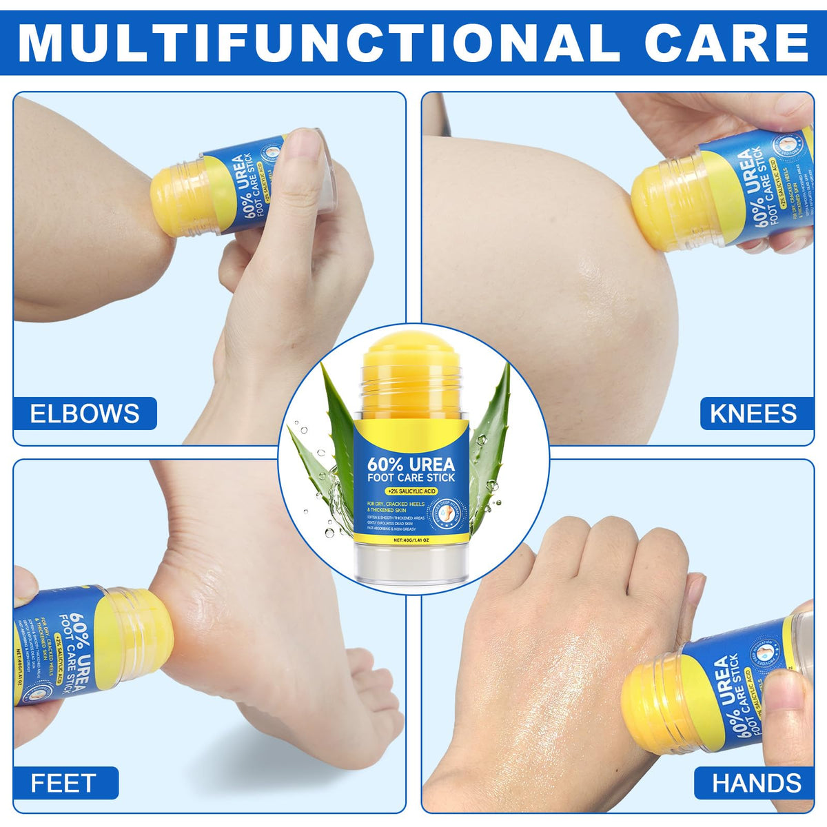 NBXINSLF 60% Urea with 2% Salicylic Acid Urea Foot Care Stick, Foot Cream Moisturizer for Dry Cracked Feet, Knees, Elbows, Hands,Moisturizes and Hydrates the Dry Skin,Callus Remover & Skin Softener -1.41oz