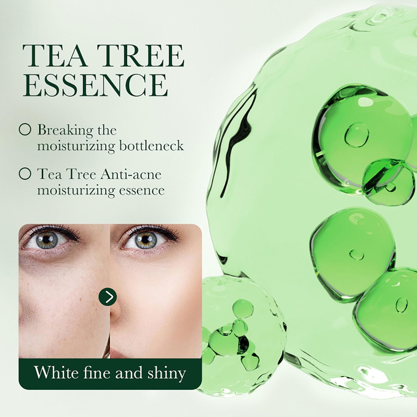 Tea Tree Acne Cream 50g - Spot Cream for Acne & Pimple - Dark Spot Remover for Face - Blackhead Remover Cream - Skin Care Face Cream for Women - Oil Control, Soothing and Moisturizing Pimple Cream