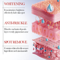 Cureluxe Dark Spot Remover For Face Cream For Women - Freckle Removal Cream – Face Moisturizer For Dark Spots – Hydrating & Skin Tone Enhancing Cream – Fade Freckles & Improve Dull Skin