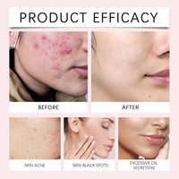 ISBEAUSOLS 80pcs Face Exfoliator Pad - Kojic Acid Cleansing Pads - Exfoliating Face Pads - Kojic Acid And Turmeric Exfoliating Pads- Clean Toner Pads Face Wipes - Brightens, Energizes Skin