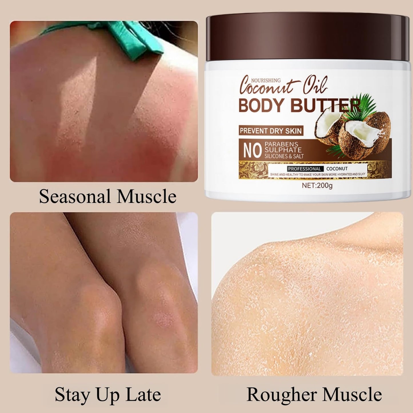 SinceReal Coconut Body Butter 200g, Coconut Oil Body Cream for Dry Skin, Nourishing, Hydrating, Softens Skin