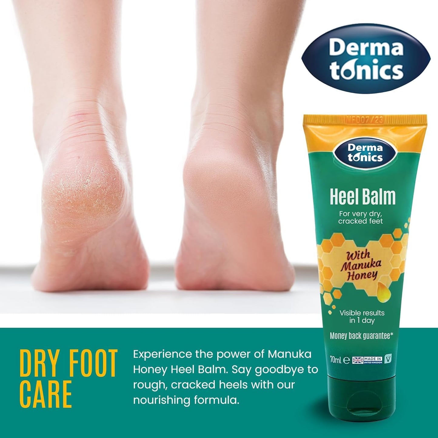 Dermatonics Fast-Acting Manuka Honey Heel Balm | Nourishing Formula for Very Dry and Cracked Heels | Visible Results in Just 1 Day | Suitable for Diabetics | 70 ml