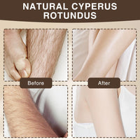 Bettinay Cyperus Rotundus Oil, 60ml Body Hair Removal Oil for All Skin Types