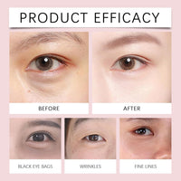 Generic Massage Eye Cream for Dark Circle, Tired Eye Refreshment with Gentle Vibration,Firm and Smooth of Fine Lines, for Anti-Wrinkle, Firming, Moisturizing