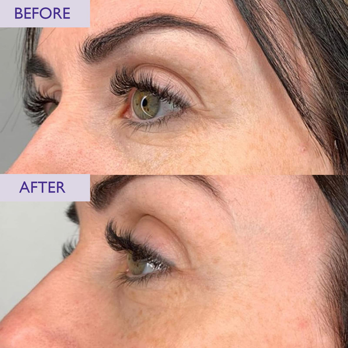 SKINICIAN Ageless Peptide Eye Complex - Anti-Wrinkle Eye Cream with Hyaluronic Acid & Vitamin C - Peptide Serum Eye Cream for Dark Circles - Stimulate Collagen Product - Vegan & Cruelty Free (15ml)