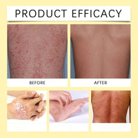 Mubuni 2PCS Bee V/enom Wrinkle Removal Cream,Bee V/enom Cream for All Skin Types,Be/e Ve/nom Crea/ms for Skin,B/ee Veno/m Comprehensive Cre/am,Be/e Ven/om Skin Treatment Cr/eam,B/ee Ve/nom Face C/ream