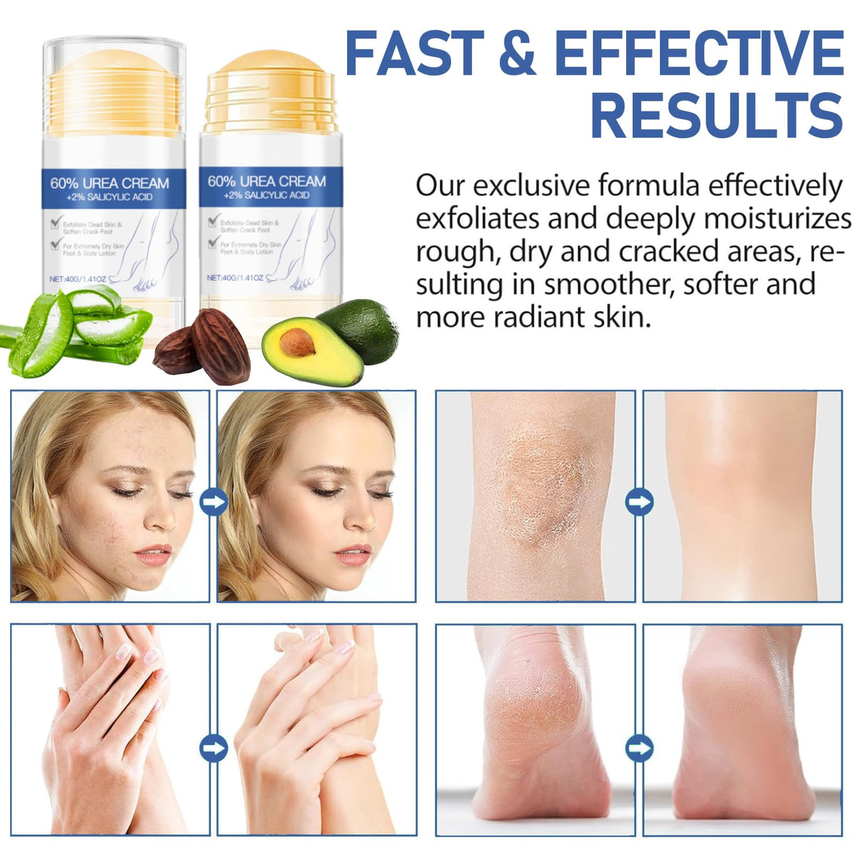 Jorun JORUN 2 Pcs Urea Foot Cream 60% + 2% Cracked Heel Repair Cream - 80 G Urea Cream for Cracked Heels and Dry Skin - Foot Cream for Hard Skin Can Deeply Moisturizes and Softens Dead Skin
