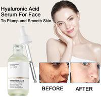 INSKIN Hyaluronic Acid 2% + B5,Skincare Serum,Hyaluronic Acid For Face Hydrated,Hyaluronic Acid Serum for Face to Plump and Smooth Skin ,Face Serum for Women & Men,Skin Care. (2pcs)