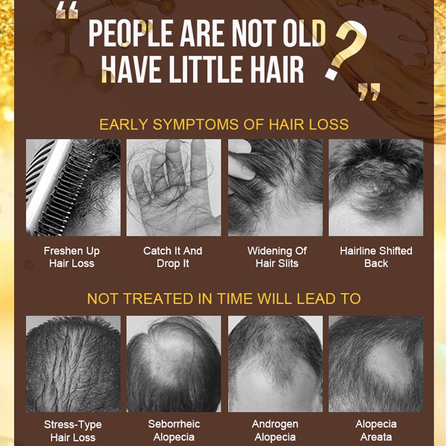 HERBENJOY Hair Growth Serum, Anti Hair Loss Essence, Hair Regrowth Serum for Alopecia Hair Loss Treatment, Bald, Thin Hair,Self-Scalp Massager Repairs Follicles Stronger Hair For Men & Women Scalp Health