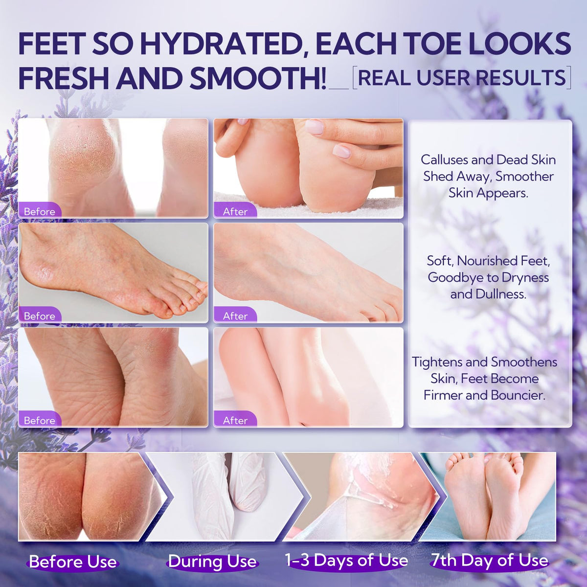LANBENA Foot Peel Mask - 1 Pair Moisturizing and Exfoliating Foot Peeling Mask for Dry, Cracked Feet | Callus Remover | Skin - Friendly and Effective for Baby Soft Feet, Men and Women (Lavender)