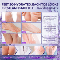 LANBENA Foot Peel Mask - 1 Pair Moisturizing and Exfoliating Foot Peeling Mask for Dry, Cracked Feet | Callus Remover | Skin - Friendly and Effective for Baby Soft Feet, Men and Women (Lavender)